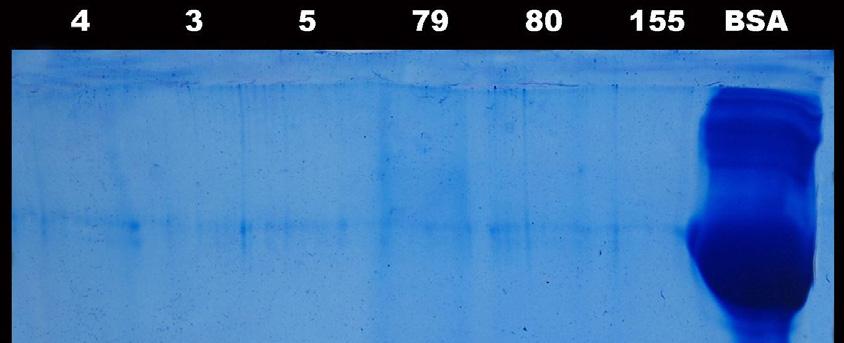 Figure 6. Confirmation of crude protein in Spirastrella inconstans by SDS-PAGE 4.