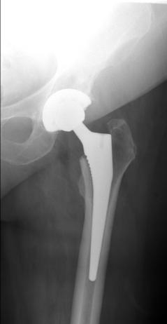 Orthopaedic Innovation Arthroscopy Joint replacement