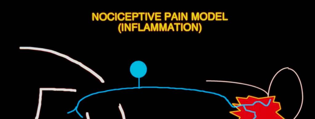 Tissue Injury/Nociceptive Pain