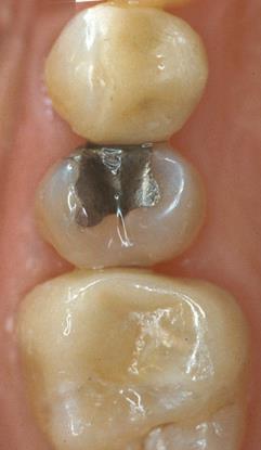 orthodontic viewpoint) Appropriate show of gingivae at rest and full smile Simply having