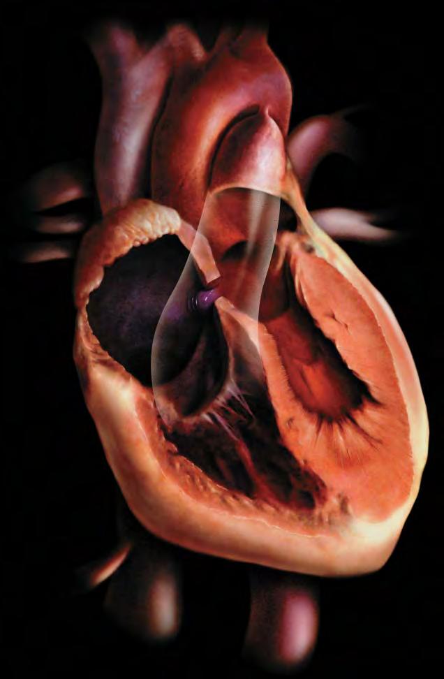 HEARTCHAPTER1.qxp 7/15/05 10:23 AM Page 14 fetal heart ductus arteriosus foramen ovale 14. fetal circulatory system After birth, the right and left sides of your heart do different things.