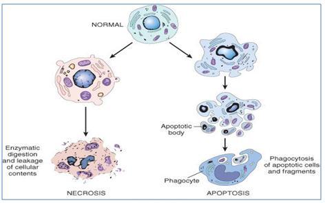 Nuclear Changes: - 1- Pyknosis 2- Karyohexis 3- Karyolysis Coagulative necrosis :- When there is 1- marked cellular injury, there is cell death.