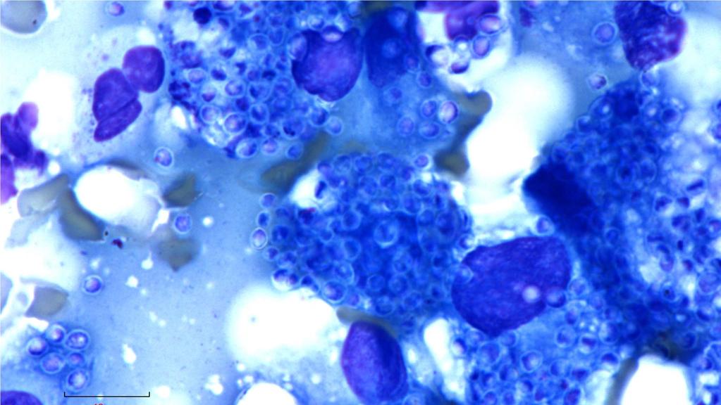 Histoplasmosis The yeasts are round, and small (and