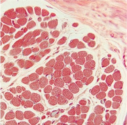 nerves 3) Endomysium: Surrounds individual muscle fibers and ties them together Satellite cells (stem cells) Endomysium Perimysium Marieb & Hoehn
