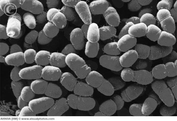 Clostridium perfringens Bacteria: Anaerobic, spore-forming, non-motile Source: Soil, dust, intestinal tract of animals and humans Illness: Infection (toxin released on sporulation) Symptoms: Intense