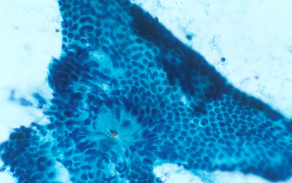 Gastric Epithelium Large flat sheets Cytoplasm of foveolar cells is