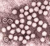 Enterovirus belong to one of the largest families of viruses; others in this family include
