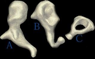 The Ossicles The Ossicular Chain A: Malleus B: Incus C: Stapes Ossicles are smallest