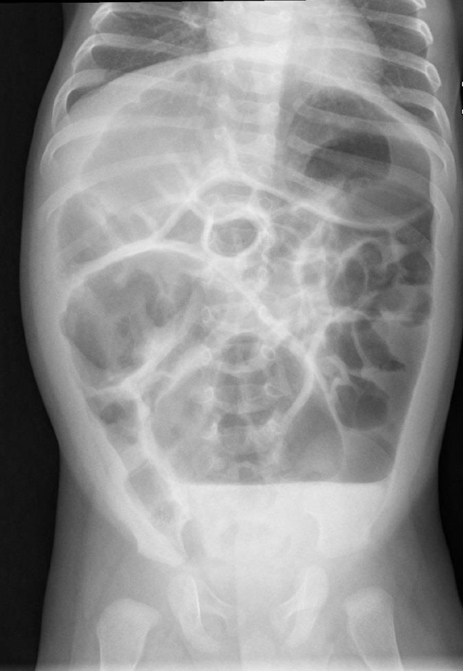 year old patient. Fig.