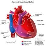 anomalies Heart failure, poor feeding, tachypnoea, poor growth Pansystolic murmur, hyperdynamic heart