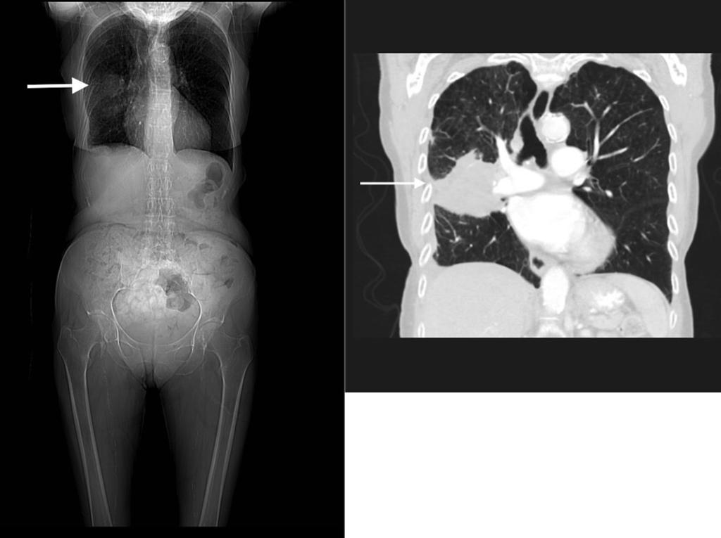 Fig. 2: Originally a CT abdomen and pelvis was requested.