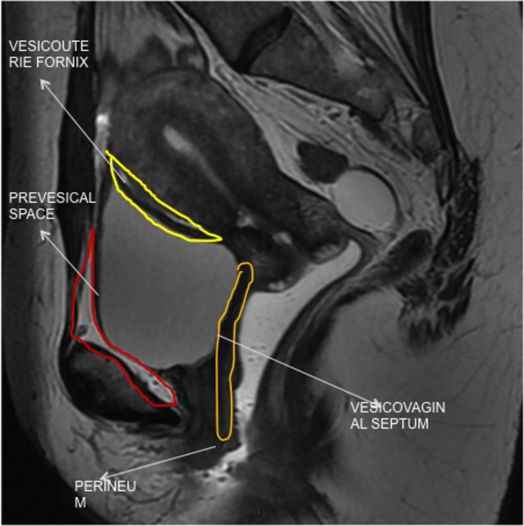 Images for this section: Fig. 1: Figure 1: Anatomy of the anterior compartment.