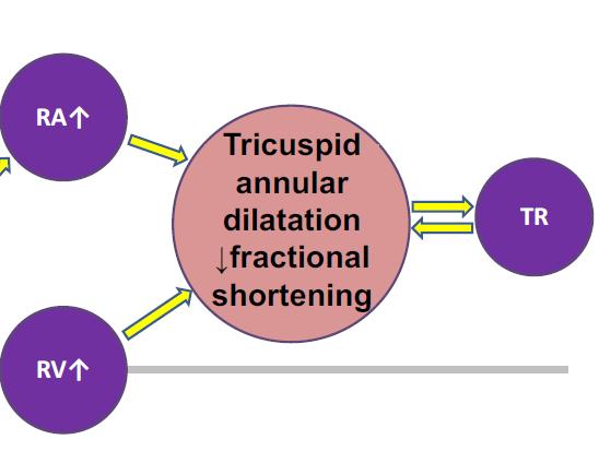 annular dilation, leaflet tethering, and loss of coaptation, which worsen the TR and create a vicious cycle.