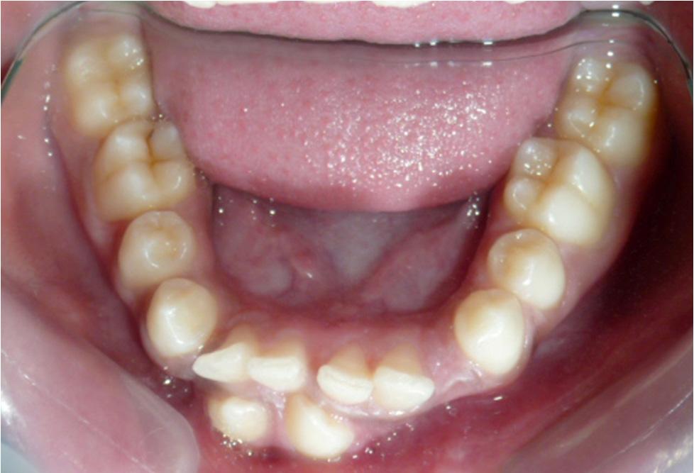 Intra-oral photograph showing