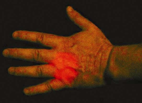 In the dark, red laser can be seen penetrating a hand.