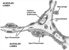 ARDS - Pathophysiology ARDS - pathophysiology Type I alveolar cells 90% of alveolar