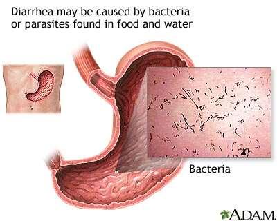Diarrhea (Large Intestine) Resulting Imbalance: