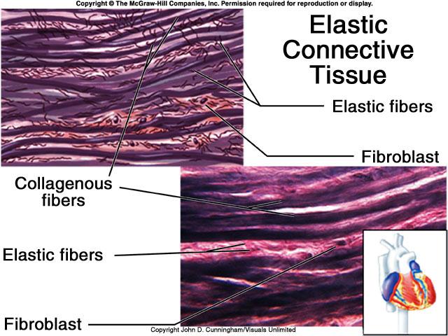 Elastic Connective Tissue Cartilage Rigid connective tissue Matrix collagenous fibers gel-like ground substance Protein-polysaccharide complex (chondromucoprotein) Lots of water Cartilage cells-