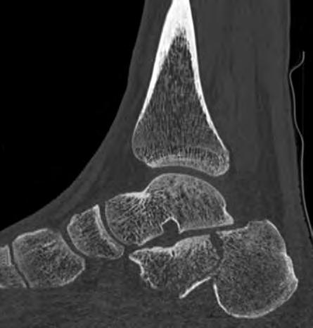 in musculoskeletal (MSK) clinical imaging has undergone tremendous improvements.