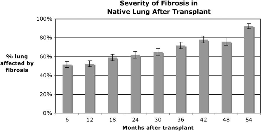432 B.M. Elicker et al. Figure 5 Plot of percentage of native lung affected by fibrosis over time after single lung transplant. Standard error of measurement bars is provided.