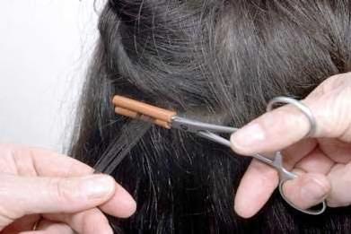 PHYSICAL Distribution Frontal, vertex, isolated patches, diffuse, or irregular Hair pull test trichogram