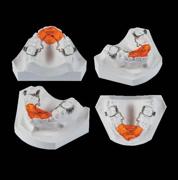 Rise Bite Plate Inserted/ Soldered* 2100/2101 Acrylic Plate Bands Additional Elements Occlusal Rests on Premolars Upper and Lower Impression* Habitual Bite