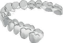 digital orthodontics Full digital system of designing and executing aligners In House