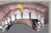 digital orthodontics Work process: Creating the user