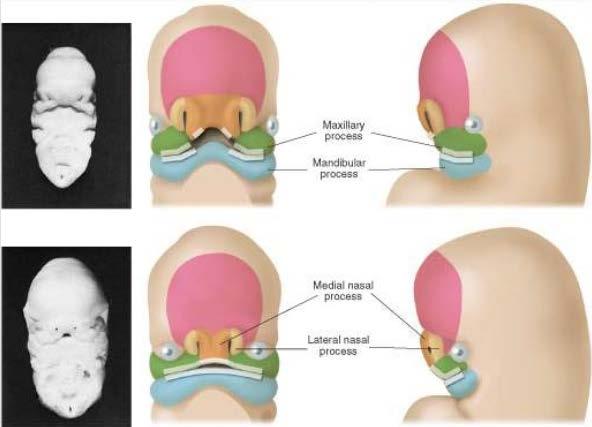 Development of the face Maxillary process and midface formation < Upper and lower lip formation> Upper lip: each