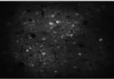 Bottom: Example two-photon image of A4b/M axons in V1.