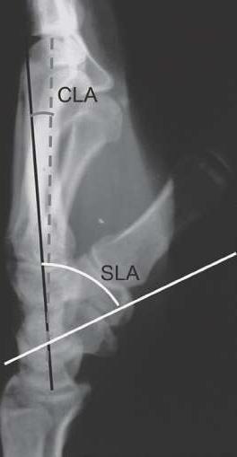 lateral radiograph [Figure 7] (7).