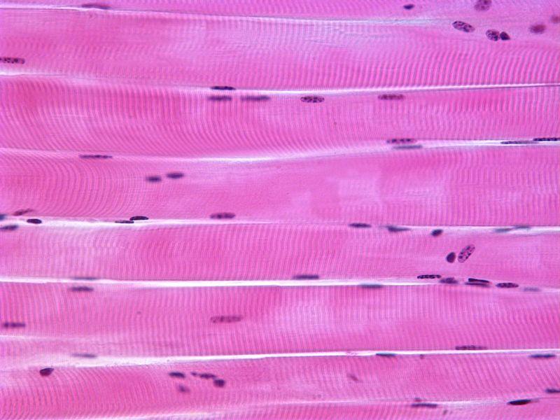 What type of tissue is this 1. Skeletal muscle 2. Cardiac muscle 3. Epithelium 4.