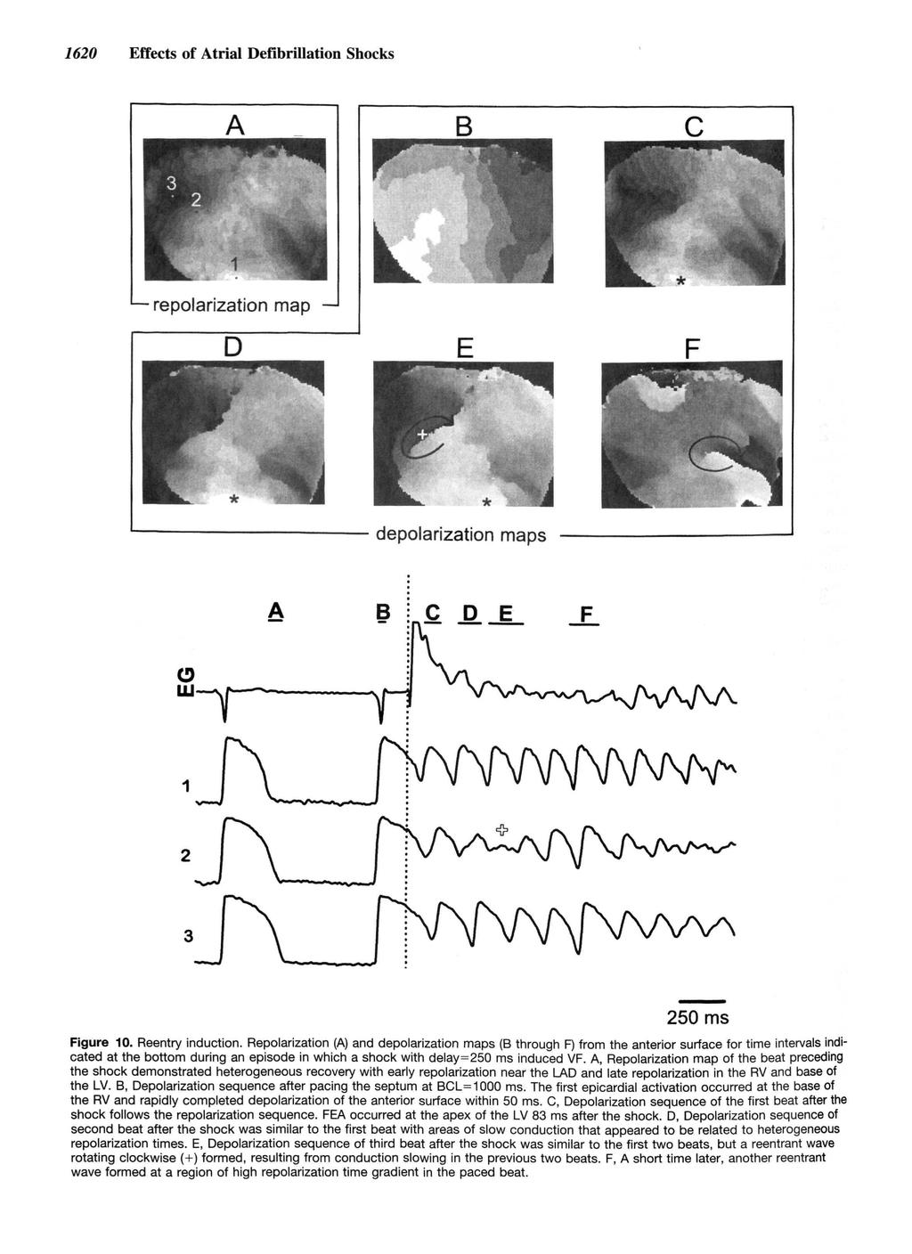 1620 Effects of Atrial Defibrillation Shocks repolarization map ' depolarization maps 250ms Figure 10. Reentry induction.