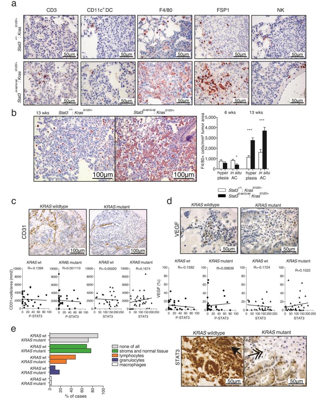 Supplementary Figure 3: STAT3 alters tumor microenvironment and angiogenesis (a) IHC pictures of CD3+ T cells, Cd11c+ dentritic cells (DC), F4/80+ macrophages, FSP1+