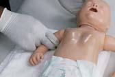 Skill 31-6: FBAO Unresponsive Infant 2. If no object is visible, open airway with head-tilt chin-lift & attempt 2 rescue breaths.