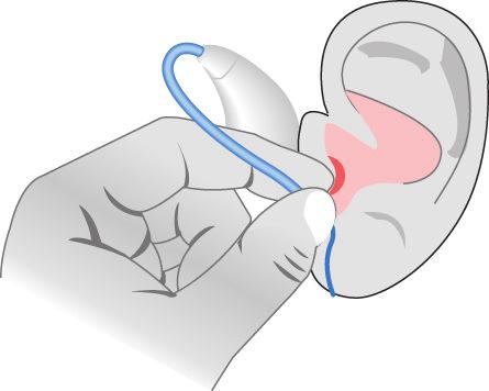 Inserting your hearing instrument Turn your hearing instrument off Hold the receiver with the Click Dome/Mould between your thumb and index finger and insert it