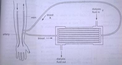 flow of blood and dialysis fluid through a kidney machine.