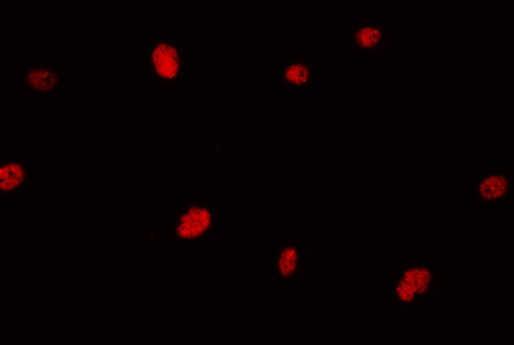glioma cells by fluorescence immunocytochemistry.