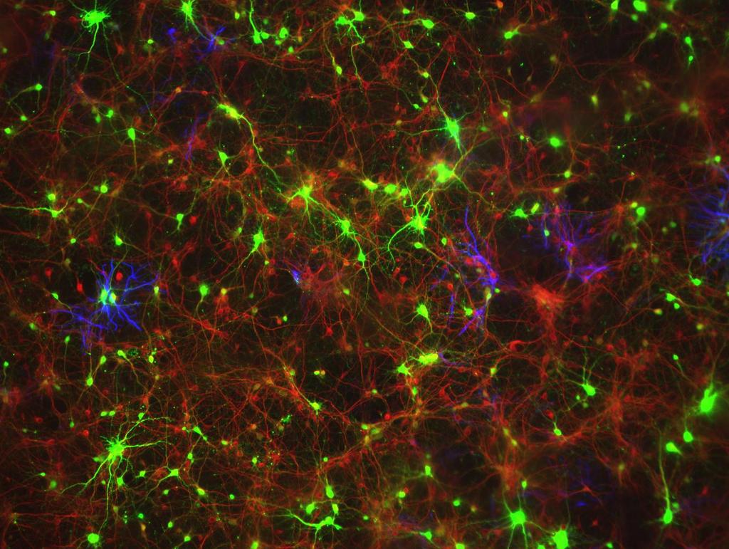 Primary Mouse Cerebral Cortex Neurons V: 80%