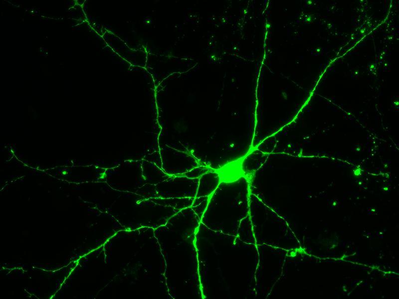 Primary Mouse Cerebral Cortex Neurons in Adherence The neurons were prepared from