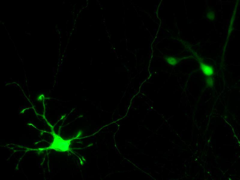 Primary Mouse Cerebral Cortex Neurons in Adherence The neurons were prepared from