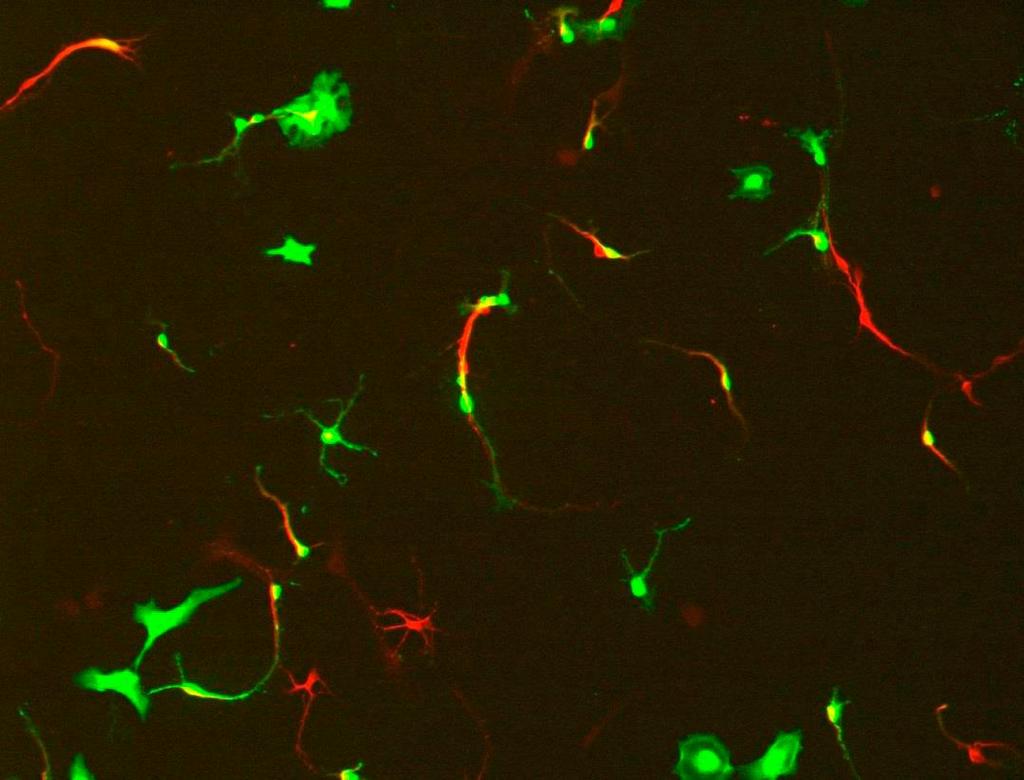 Primary Mouse Hippocampal Neurons Pictures: 3