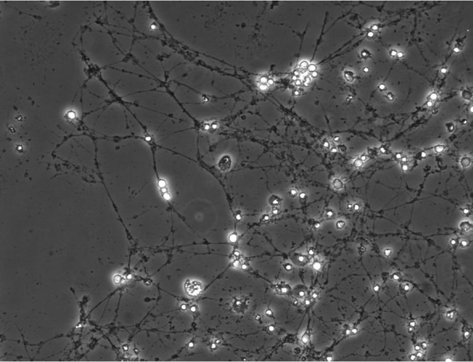 Primary Rat Hippocampal Neurons in