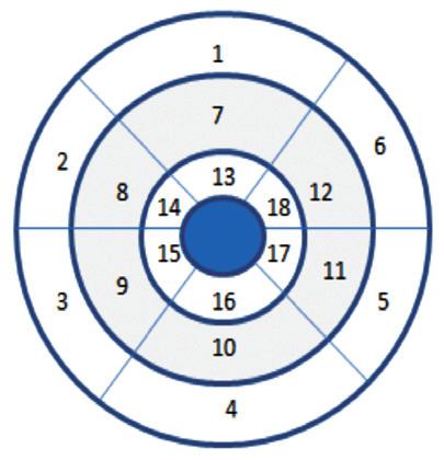 distal (D)) level Segments 13-16, Apex level; Segment 17 Segments 1,7,13 = anterior, Segments 2,8,14 = antero-septal, Segments 3,9,15 = infero-septal, Segments 4,10,16 = inferior, Segments 5,11,17 =