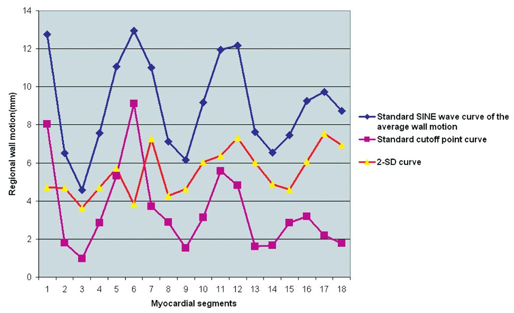 Impaired Regional Myocardial Function Detection Using the Standard Inter-Segmental Integration Figure 4: Demonstration of strandard SINE wave curve, myocardial segment specific 2-SD curve and