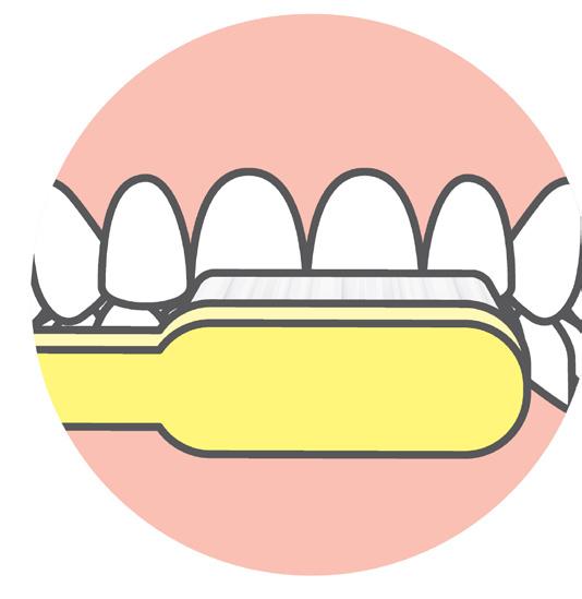 It s called a sealant, a thin, protective coating (made from plastic or other dental material) that adheres to the chewing surface of the back teeth.