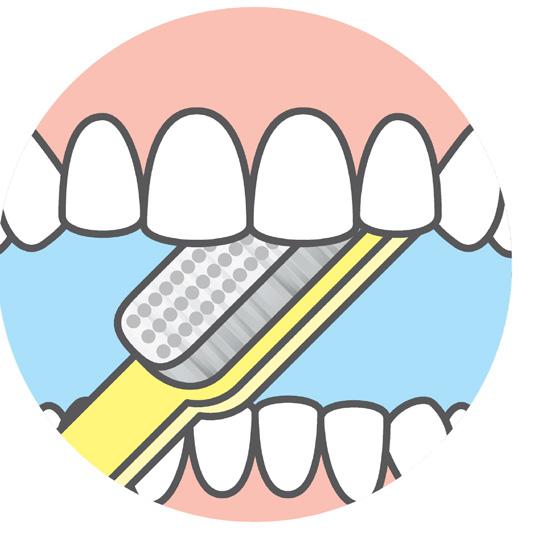Fluoride treatments prevent cavities by strengthening the hard, outer shell of the teeth, and they may even reverse very early cavities that have just started to form.