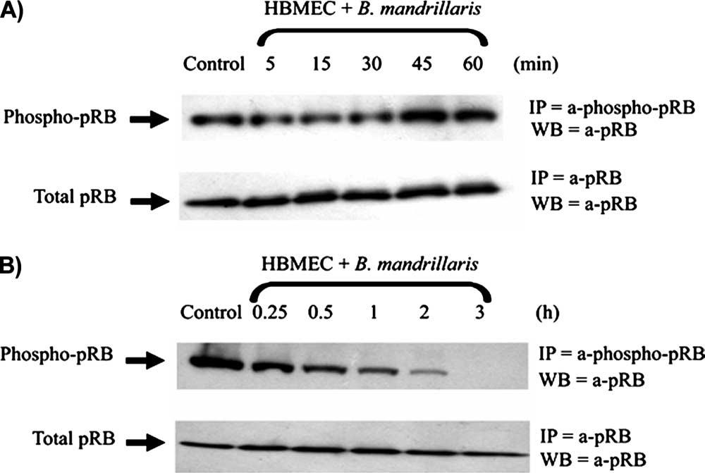 444 MATIN ET AL. CLIN. MICROBIOL. REV. FIG. 4. Balamuthia mandrillaris-induced prb dephosphorylation in HBMEC, using Western blotting (WB) assays.