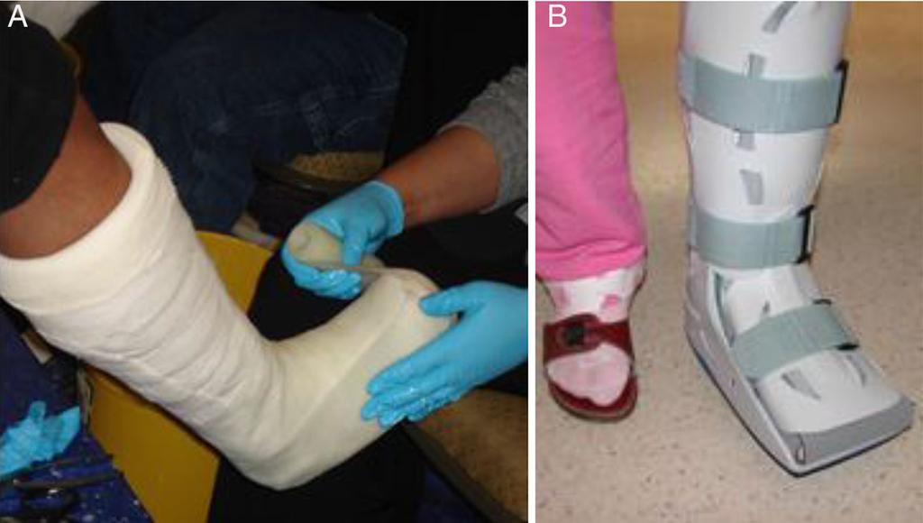 Treatment of the chronic Charcot foot and ankle in identifying the disease in early stages, providing prognostic data or direct the clinician to specific treatment options.
