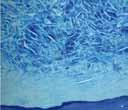 mucoderm Soft Tissue Graft mucoderm is a 3D collagen tissue matrix derived from porcine dermis that passes through a multi-step